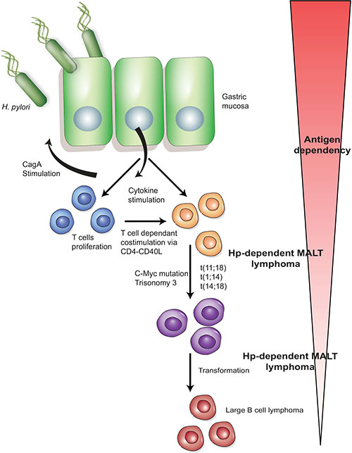 lymphoma2